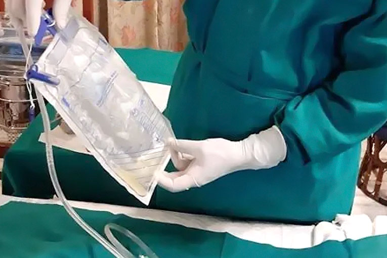 urinery-catheter